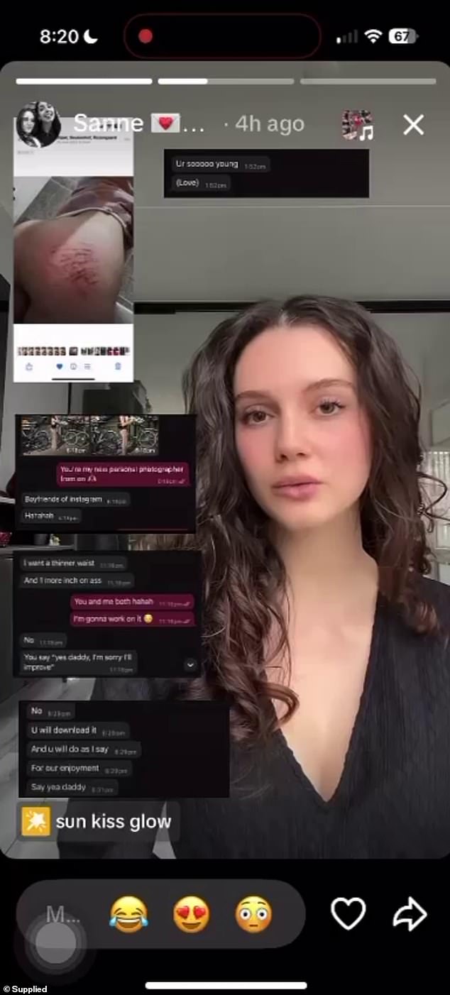 Ms van Ooijen posted a picture of a bruised bottom on TikTok, saying it was hers. The 25-year-old claimed 38-year-old Lewis hit her on the backside when she would not call him her 'God'