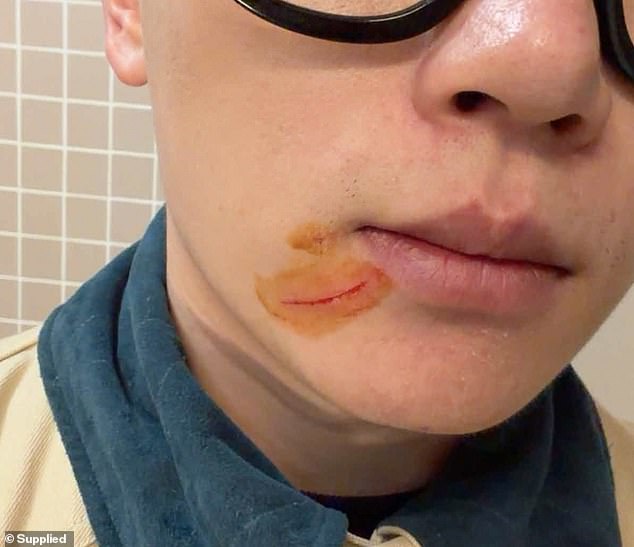 Lenny Tai, 29, bore the brunt of the alleged physical attack, and had scratches on his face